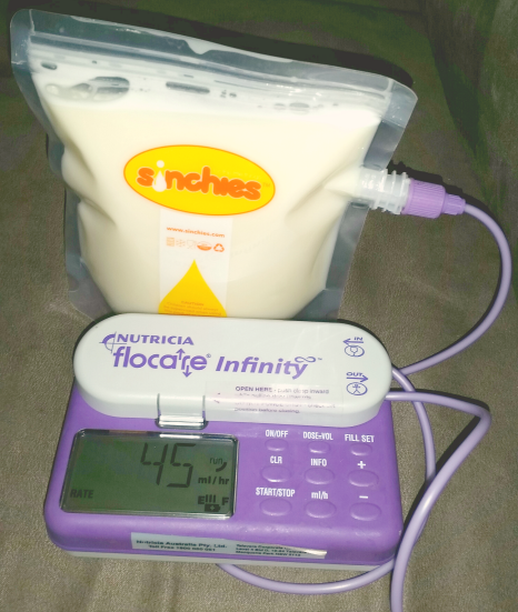 Infinity feeding pump and sinchies reusable feeding bag tube feeding